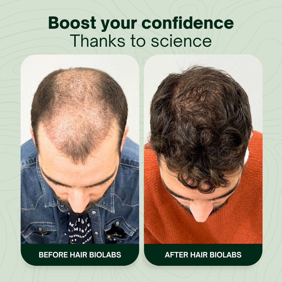 Hair Biolabs Hair Regrowth Micro-Infusion System