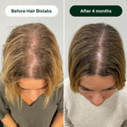Hair Biolabs REDENSIFY™ - Stops Hair Loss in 21 Days