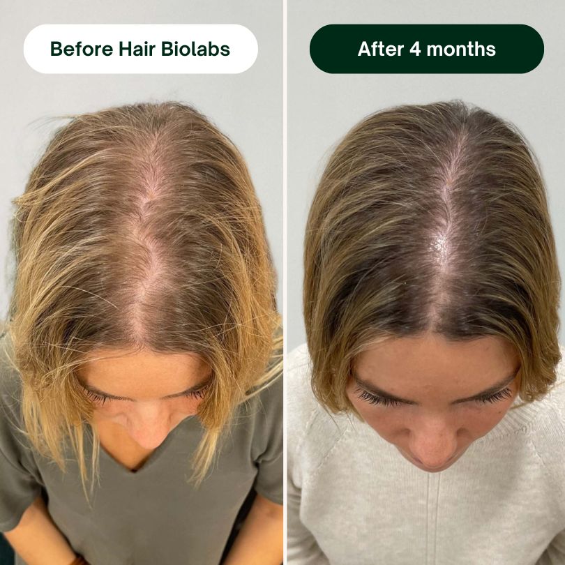 Hair Biolabs - Hair Regrowth System