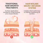 Hair Biolabs REDENSIFY™ - Stops Hair Loss in 21 Days
