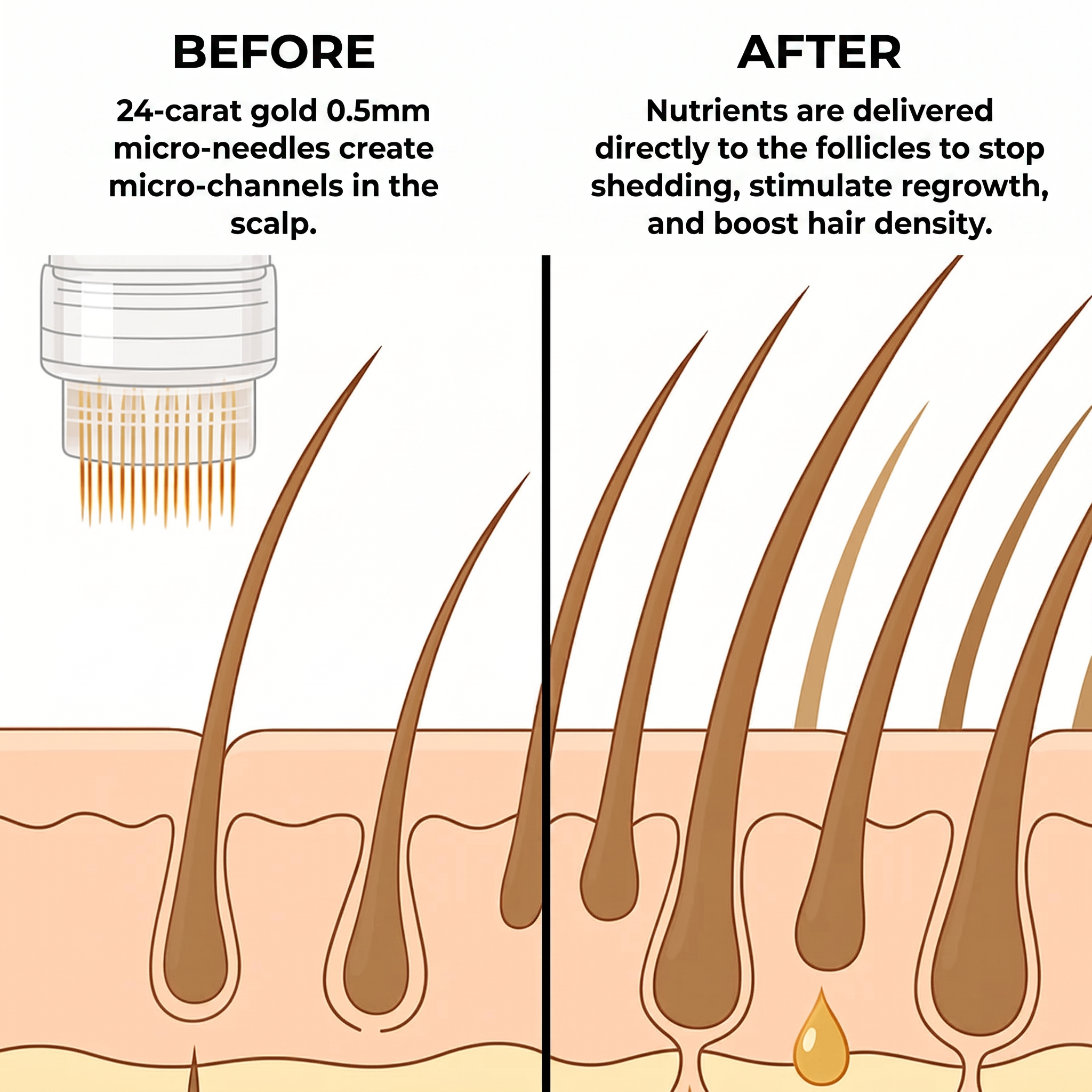 Women's Micro-Infusion - Hair Technology