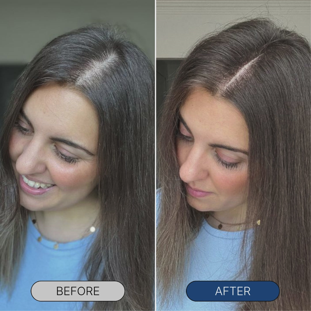 Women's Micro-Infusion - Hair Technology